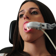 Load image into Gallery viewer, eBite Portable Set, Intraoral Lighting System, eBite Portable Set | US Ophthalmic, US Ophthalmic | Ophthalmology & Optometry Equipment for sale