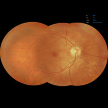 Load image into Gallery viewer, EFC-2600, , EFC-2600 Ezer Retinal Camera | US Ophthalmic, US Ophthalmic | Ophthalmology & Optometry Equipment for sale