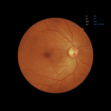 Load image into Gallery viewer, EFC-2600, , EFC-2600 Ezer Retinal Camera | US Ophthalmic, US Ophthalmic | Ophthalmology & Optometry Equipment for sale