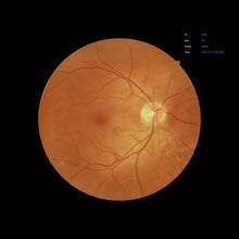 Load image into Gallery viewer, EFC-2600, , EFC-2600 Ezer Retinal Camera | US Ophthalmic, US Ophthalmic | Ophthalmology & Optometry Equipment for sale