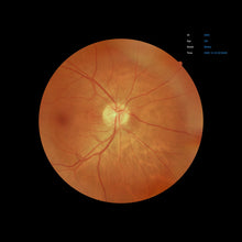 Load image into Gallery viewer, EFC-2600, , EFC-2600 Ezer Retinal Camera | US Ophthalmic, US Ophthalmic | Ophthalmology & Optometry Equipment for sale