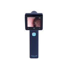 Load image into Gallery viewer, EZ-Horus OTO Blue, Digital Otoscope, EZ-Horus OTO Blue Ezer Digital Otoscope | US Ophthalmic, US Ophthalmic | Ophthalmology & Optometry Equipment for sale