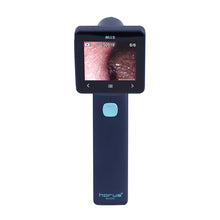 Load image into Gallery viewer, EZ-Horus OTO Blue, Digital Otoscope, EZ-Horus OTO Blue Ezer Digital Otoscope | US Ophthalmic, US Ophthalmic | Ophthalmology & Optometry Equipment for sale