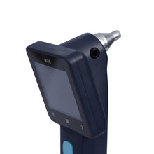 Load image into Gallery viewer, EZ-Horus OTO Blue, Digital Otoscope, EZ-Horus OTO Blue Ezer Digital Otoscope | US Ophthalmic, US Ophthalmic | Ophthalmology & Optometry Equipment for sale
