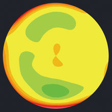 Load image into Gallery viewer, HOCT-Topography Module, , HOCT Topography Module Huvitz | US Ophthalmic, US Ophthalmic | Ophthalmology & Optometry Equipment for sale