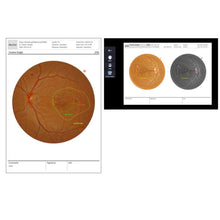 Load image into Gallery viewer, Software Artificial Inteligence, , Huvitz Med® - Fundus AI™ Huvitz Software Artificial Inteligence | US Ophthalmic, US Ophthalmic | Ophthalmology & Optometry Equipment for sale