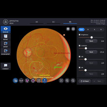 Load image into Gallery viewer, Software Artificial Inteligence, , Huvitz Med® - Fundus AI™ Huvitz Software Artificial Inteligence | US Ophthalmic, US Ophthalmic | Ophthalmology & Optometry Equipment for sale