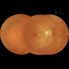 Load image into Gallery viewer, Open Box - EFC-2600 - US Ophthalmic
