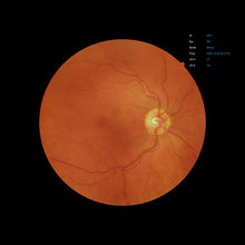 Load image into Gallery viewer, Open Box - EFC-2600 - US Ophthalmic
