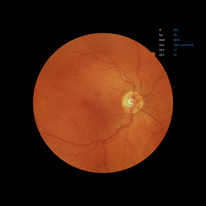 Open Box - EFC-2600 - US Ophthalmic