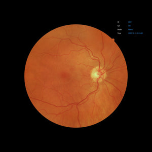 Open Box - EFC-2600 - US Ophthalmic