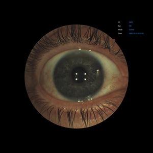 Open Box - EFC-2600 - US Ophthalmic