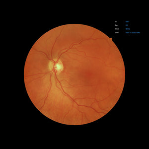 Open Box - EFC-2600 - US Ophthalmic