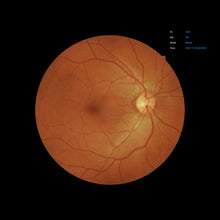 Load image into Gallery viewer, Open Box - EFC-2600 - US Ophthalmic
