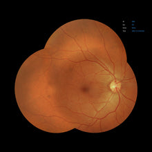 Load image into Gallery viewer, Open Box - EFC-2600 - US Ophthalmic
