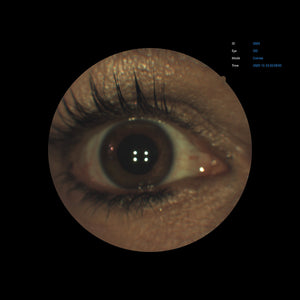 Open Box - EFC-2600 - US Ophthalmic