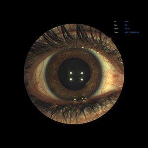 Open Box - EFC-2600 - US Ophthalmic