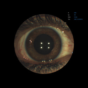 Open Box - EFC-2600 - US Ophthalmic