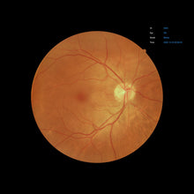 Load image into Gallery viewer, Open Box - EFC-2600 - US Ophthalmic
