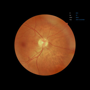 EFC-2600 - US Ophthalmic