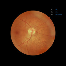 Load image into Gallery viewer, Open Box - EFC-2600 - US Ophthalmic
