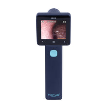 Load image into Gallery viewer, EZ-Horus OTO Blue - US Ophthalmic
