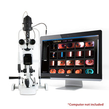 Load image into Gallery viewer, HIS-5000 5X - US Ophthalmic
