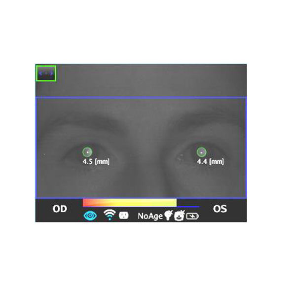 DP-App - US Ophthalmic
