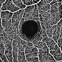 Load image into Gallery viewer, H Angio Module - US Ophthalmic
