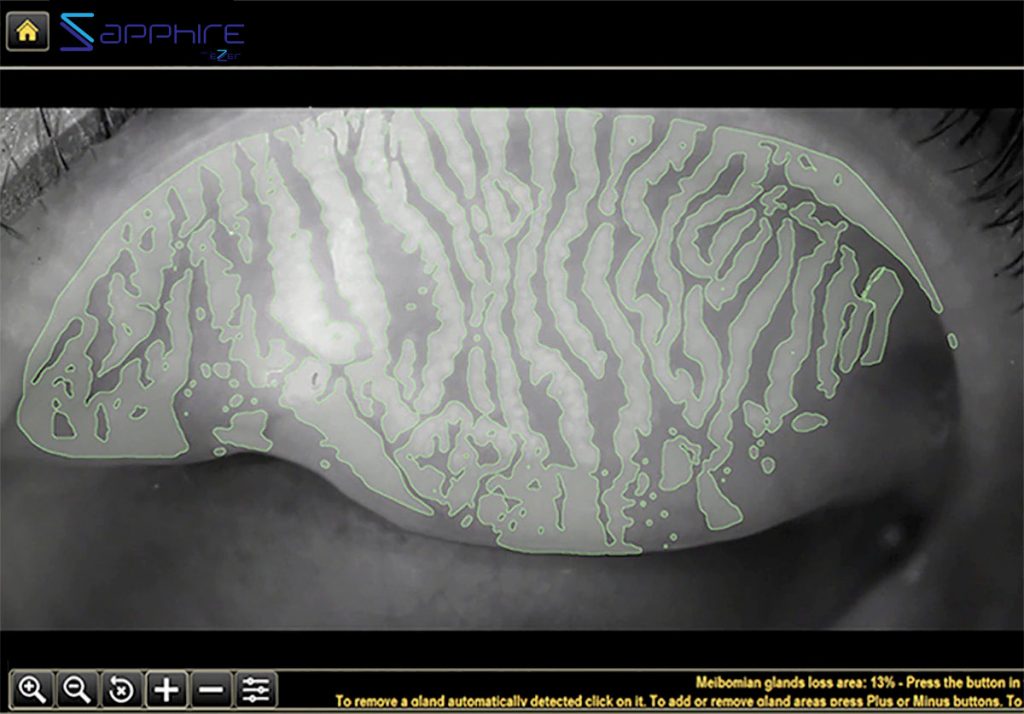 Ezer Dry Eye Sapphire A – image 10