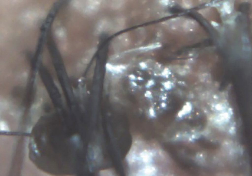 Ezer Dry Eye Sapphire A – image 19