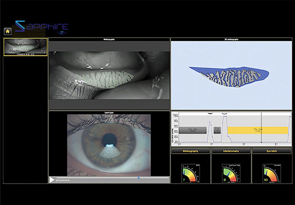 Ezer Dry Eye Sapphire A+ – image 2