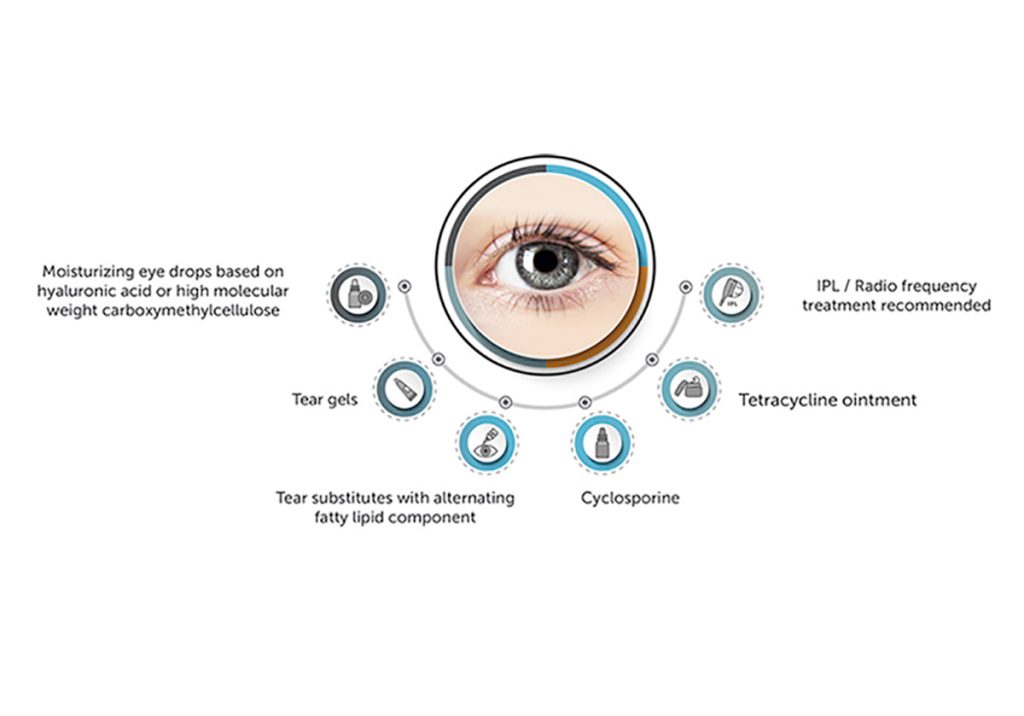 Ezer Dry Eye Sapphire A – image 22