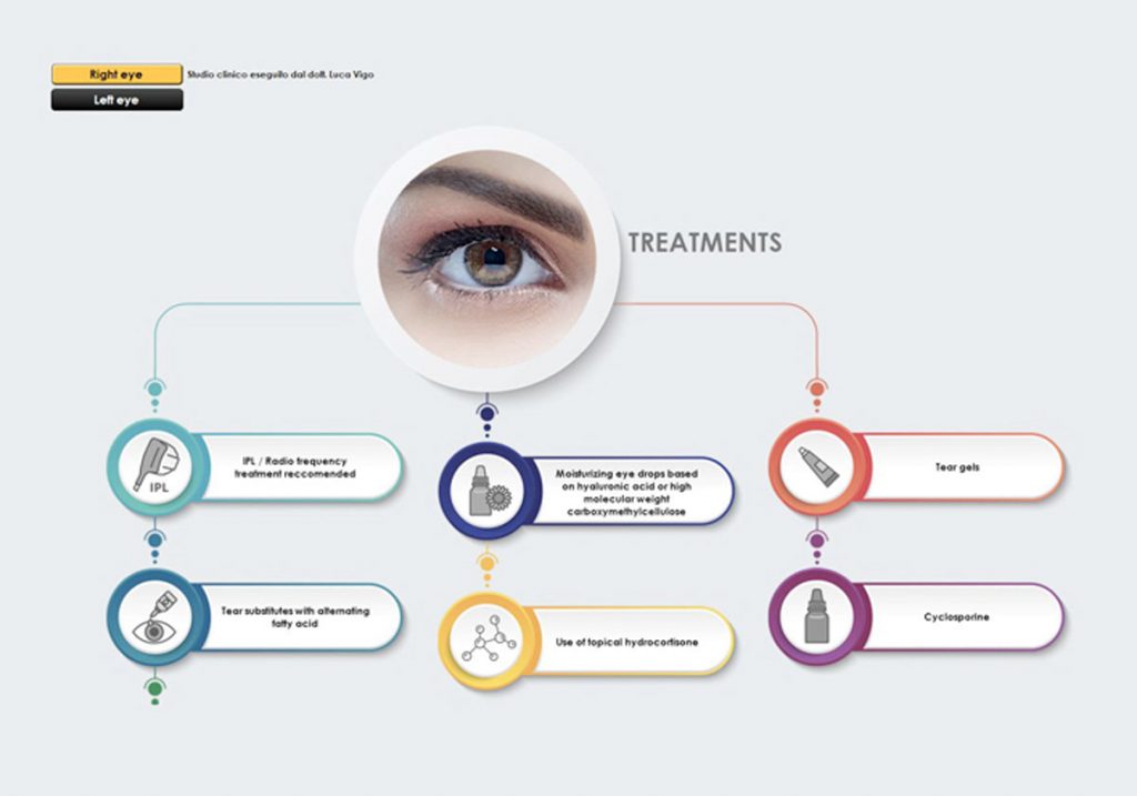 Ezer Dry Eye Sapphire A+ – image 25