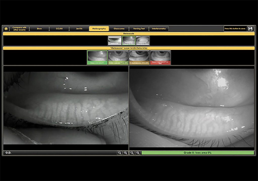 Ezer Dry Eye Sapphire A – image 26