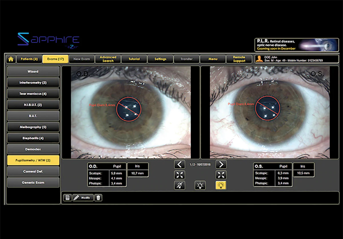 Ezer Dry Eye Sapphire A