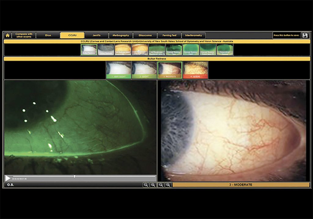 Ezer Dry Eye Sapphire A – image 28