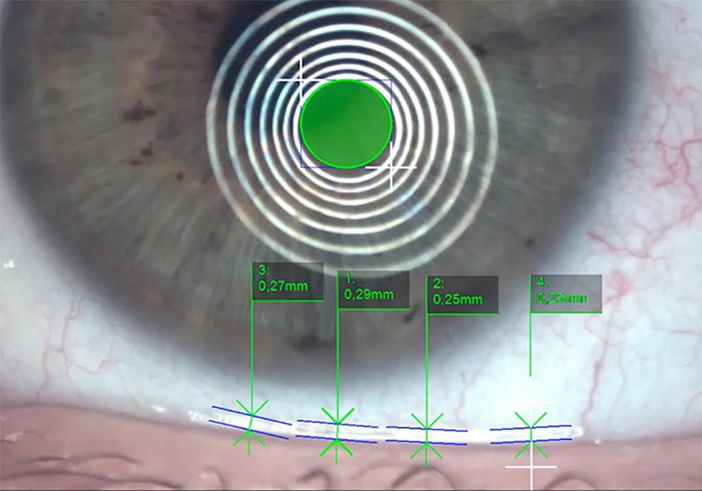 Ezer Dry Eye Sapphire A – image 4