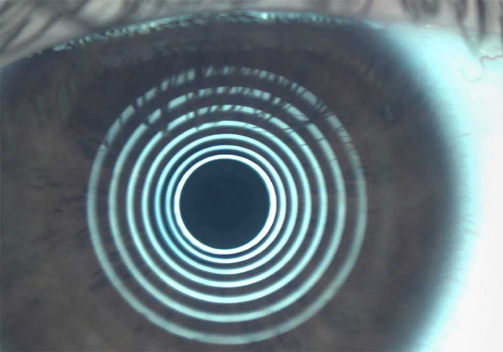 Ezer Dry Eye Sapphire A – image 5