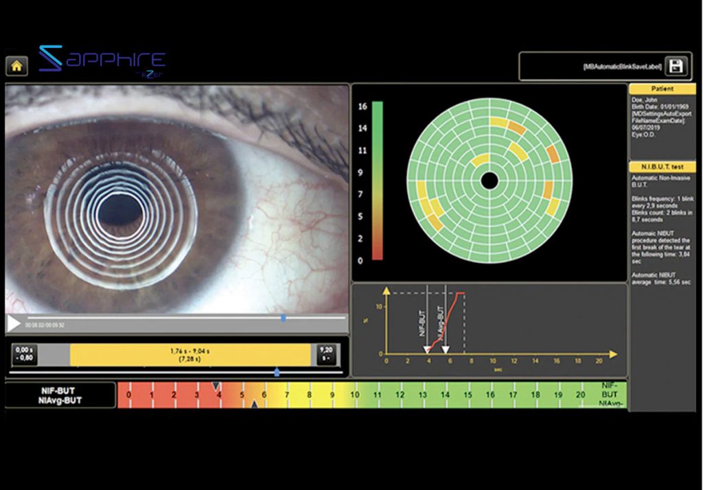 Ezer Dry Eye Sapphire A – image 6