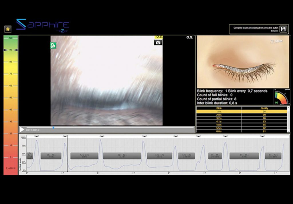 Ezer Dry Eye Sapphire A+ – image 8