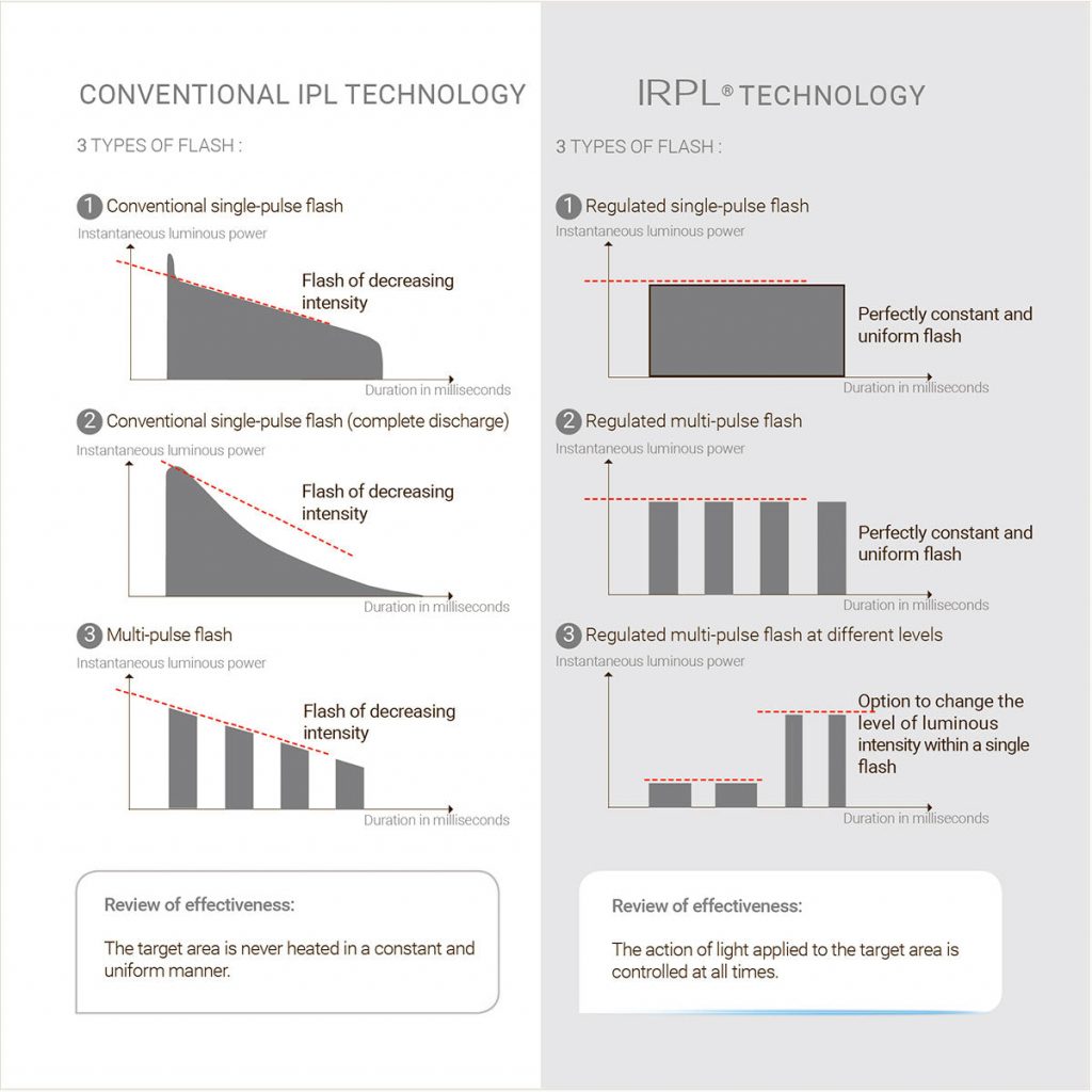 E-SWIN E-EYE IRPL Treatment IRPL – image 3