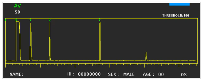 Ezer Biometer + Pachymeter EUS-1800 AP – image 8