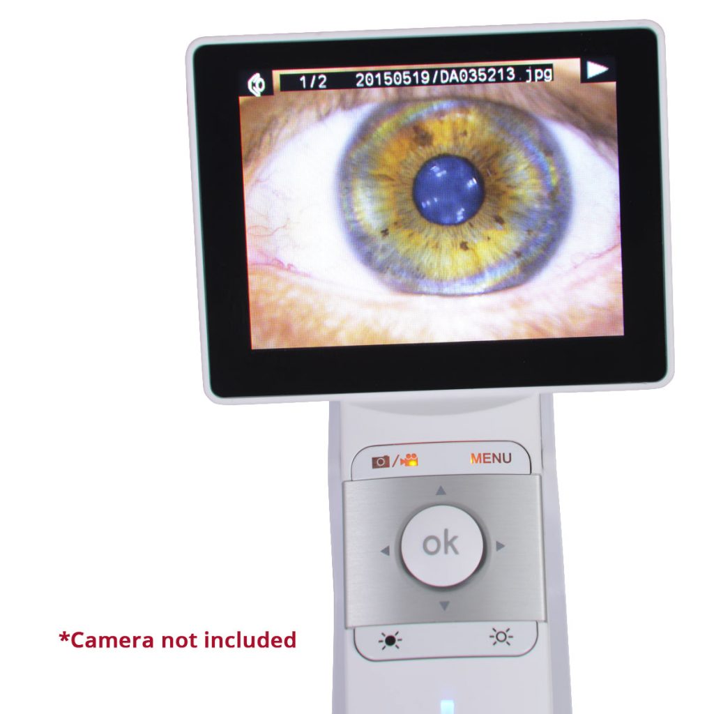 Ezer Anterior Lens EZ-Horus Anterior Lens – image 9