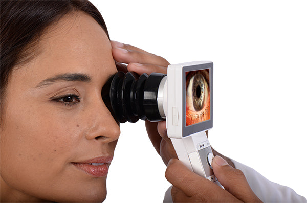 Ezer Anterior Lens EZ-Horus Anterior Lens – image 1