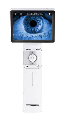 Ezer Anterior Lens EZ-Horus Anterior Lens – image 2