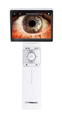 Ezer Anterior Lens EZ-Horus Anterior Lens – image 3