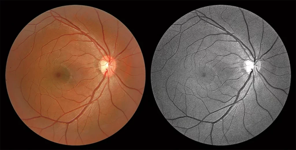 Huvitz Fundus Camera HFC-1 – image 4