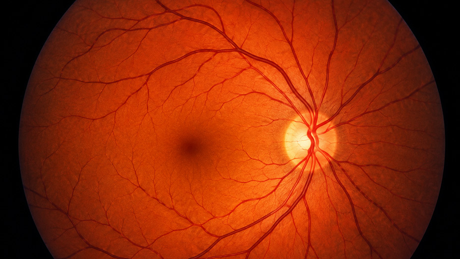 Retina and Fundus