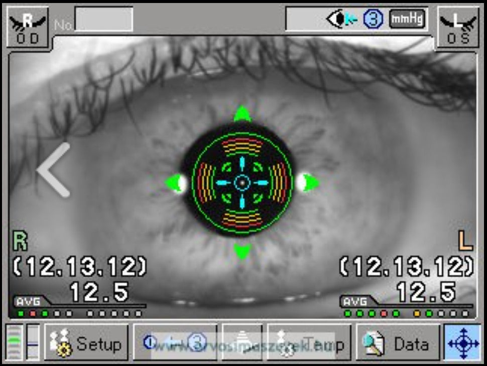 Tomey Non-Contact Tonometer FT-1000 – image 10
